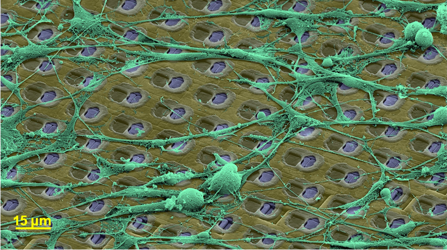 Enlarged view: Nerve cells